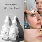 Face Serum Whitening Vitamin C Hyaluronic Acid-BH00215-Veeddydropshipping